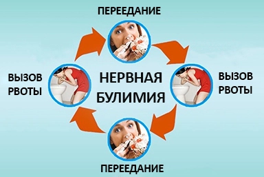 Лечение булимии в Ветлужском
